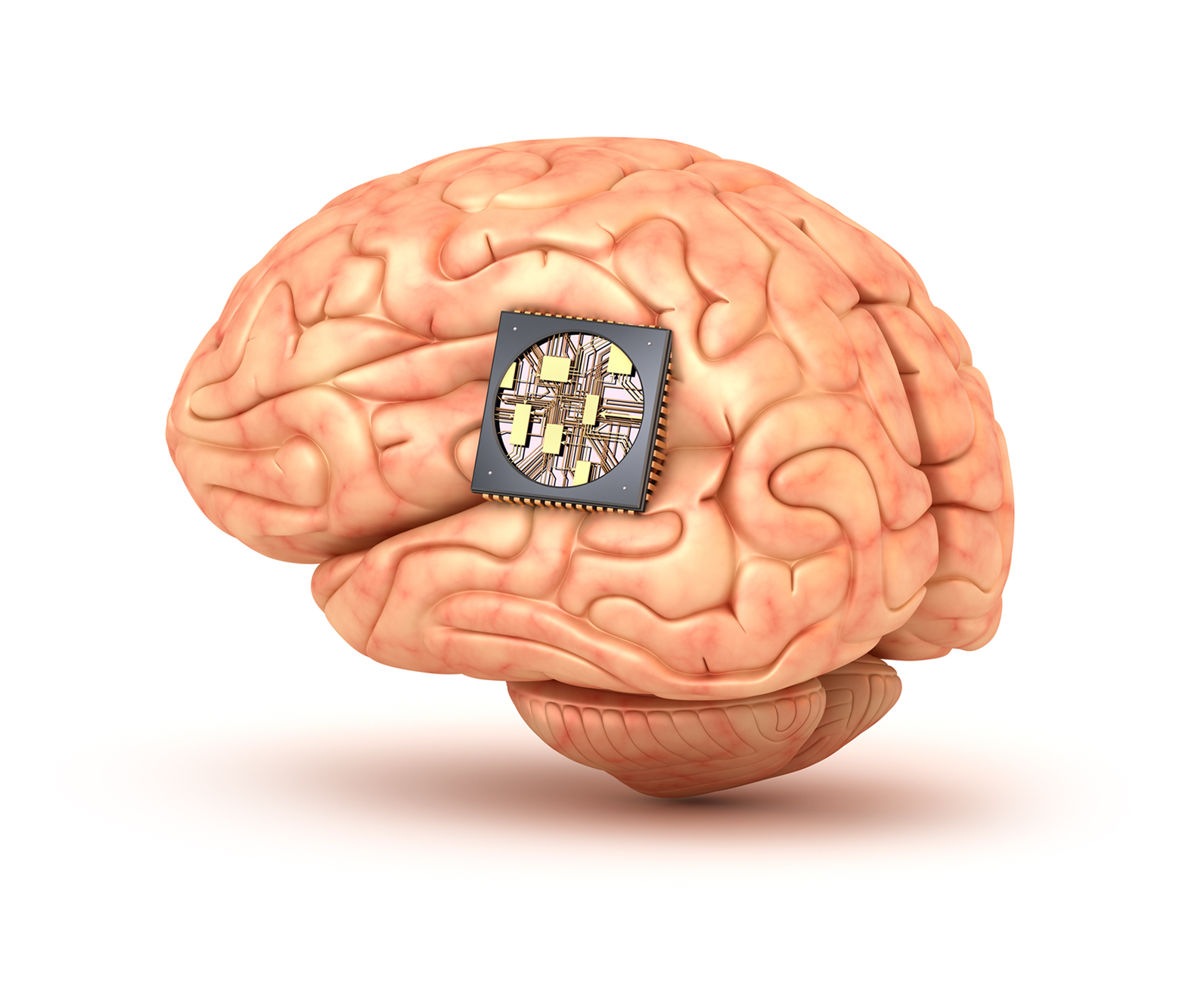 Brain with microchip